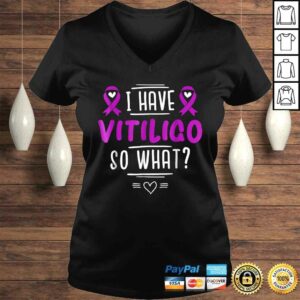 Official Purple Awareness Ribbon - I Have Vitiligo So WhaShirt 1 Official Purple Awareness Ribbon I Have Vitiligo So WhaShirt 2