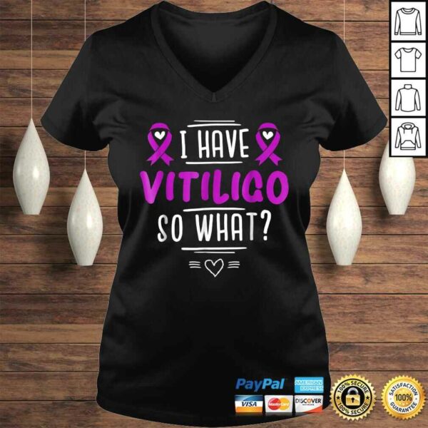 Official Purple Awareness Ribbon – I Have Vitiligo So WhaShirt