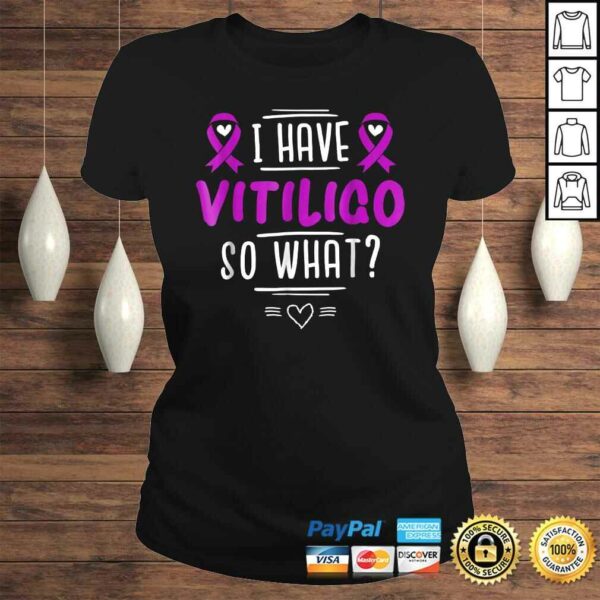 Official Purple Awareness Ribbon – I Have Vitiligo So WhaShirt