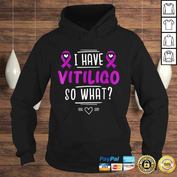 Official Purple Awareness Ribbon – I Have Vitiligo So WhaShirt